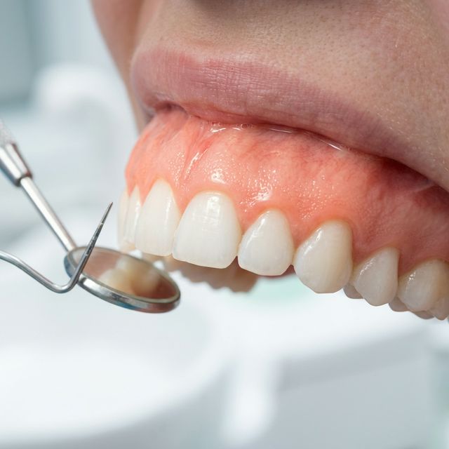 Recognizing and Treating Gum Disease Early in Warminster