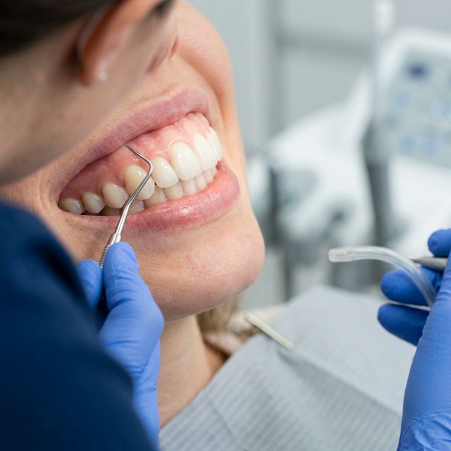 Why Regular Teeth Cleaning Matters More Than You Think