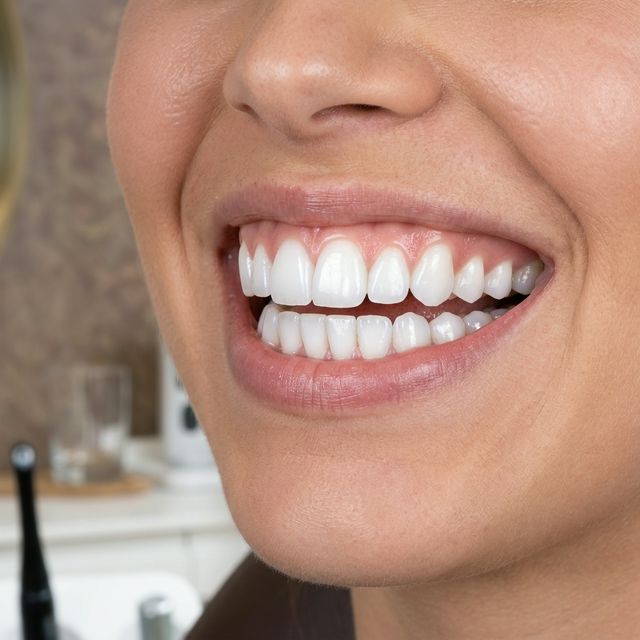 Keeping Your Smile Bright: The Benefits of Professional Dental Cleanings